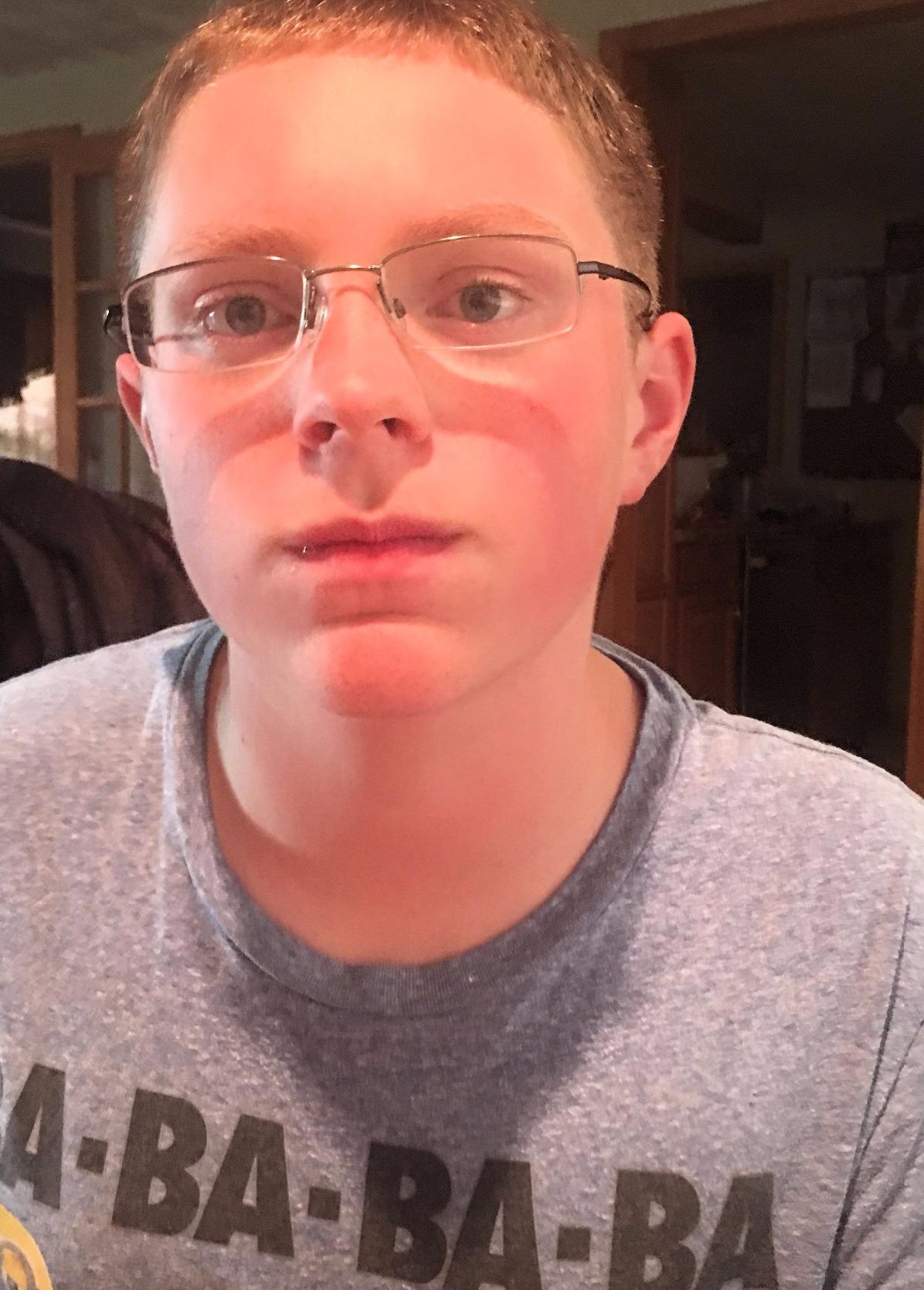 Shock Doctor Double Braces Strapless Mouth Guard, Blue, Adult customer photo 1