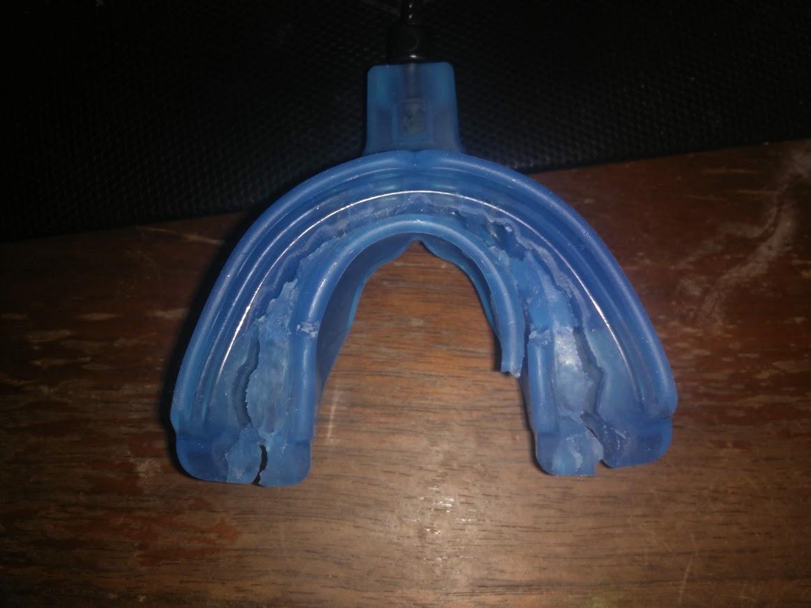 Shock Doctor Braces Football Mouth Guard, Upper & Lower Teeth Protection, Adult/Youth Sizes with Helmet Strap, Mouthguard for Sports, Football, Hockey, Lacrosse, Baseball, Wrestling, More customer photo 1