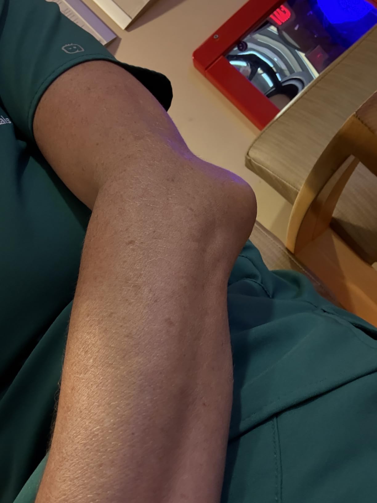 McDavid 6500 HexPad Power Shooter Arm Sleeve customer photo 2