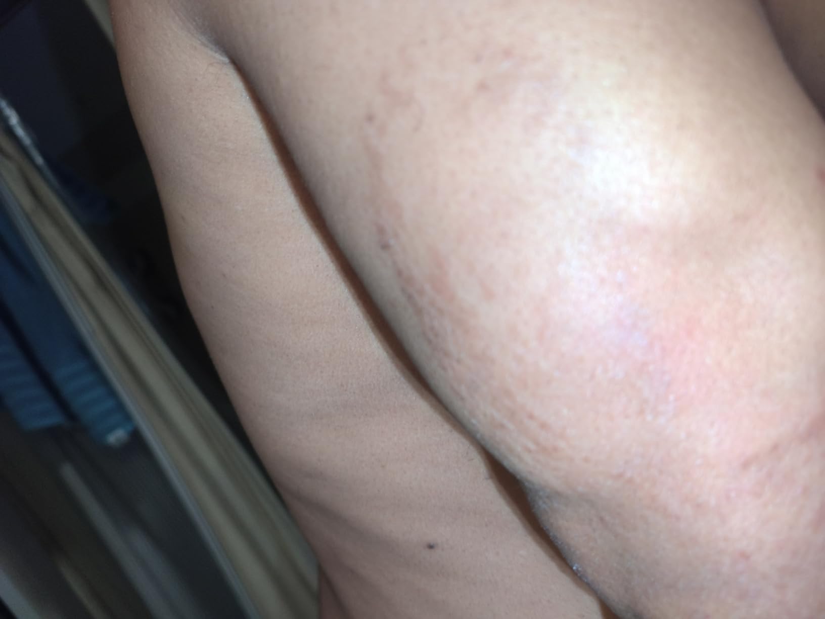 Taping - Elastic Therapeutic Athletic Tape Tex Gold FP - Beige- 2 in. x 16.4 ft - 2 Pack customer photo 1