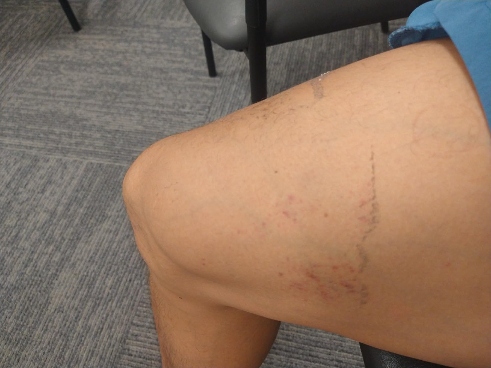 Taping - Elastic Therapeutic Athletic Tape Tex Gold FP - Beige- 2 in. x 16.4 ft - 2 Pack customer photo 2