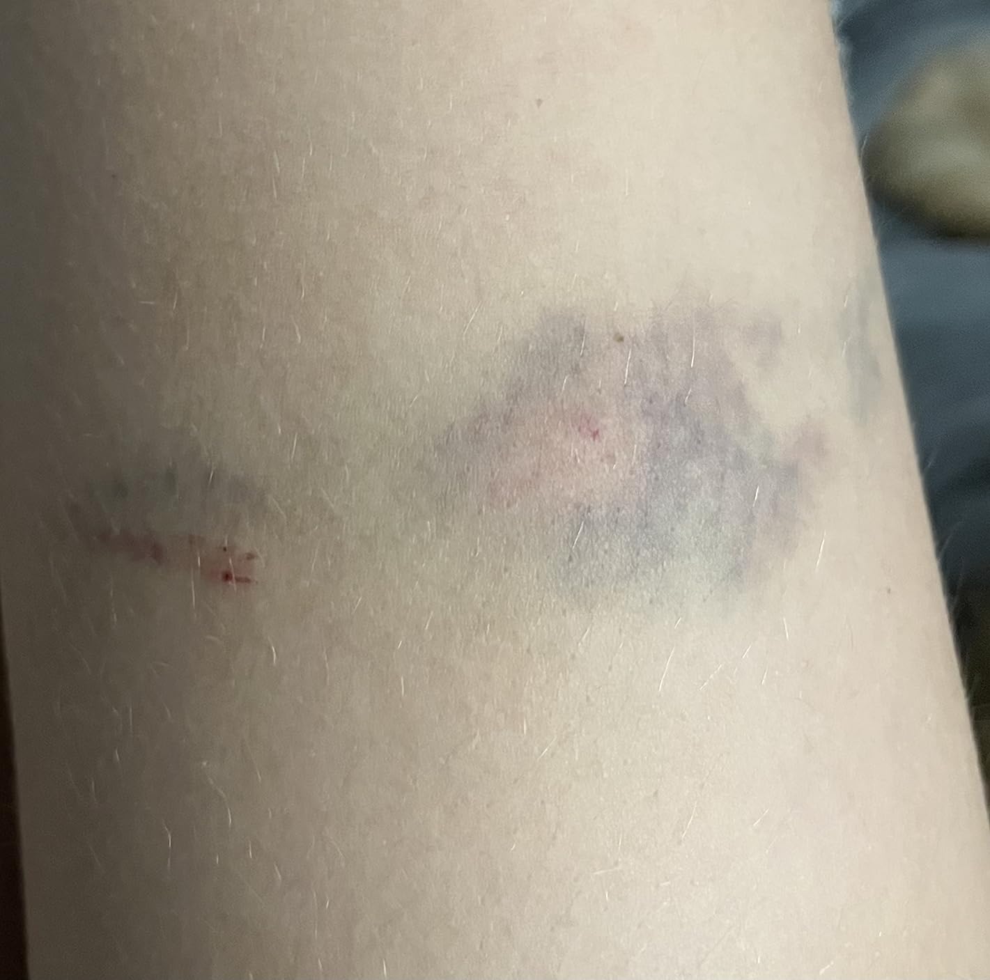 DANCEYOU Ice Skate Figure Skating Tights Over The Boot Crystal for Child Women customer photo 1