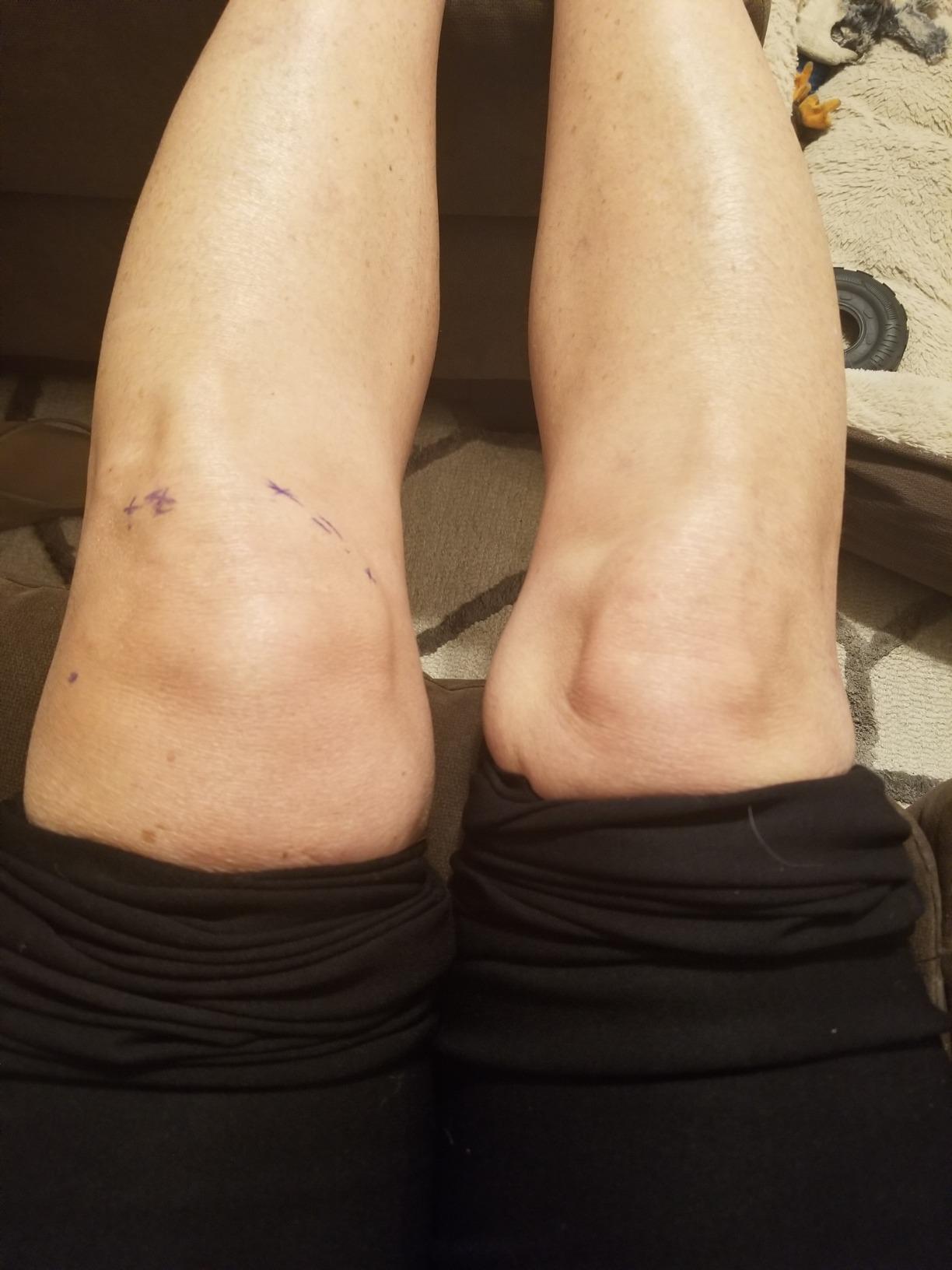 SPRI Slide Board (71