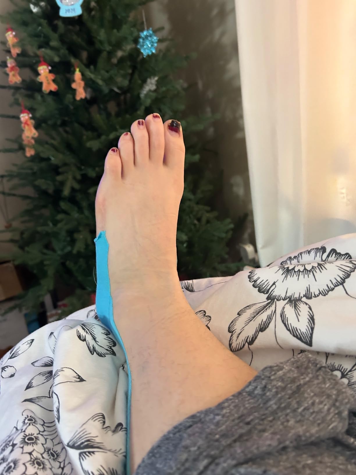 As Seen on Shark Tank | Elastic Kinesiology Tape (2-Pack) | Uncut Athletic Tape Supports & Protects Muscles Knees Shoulders & Plantar Fasciitis | Waterproof Hypoallergenic (Beige) customer photo 1