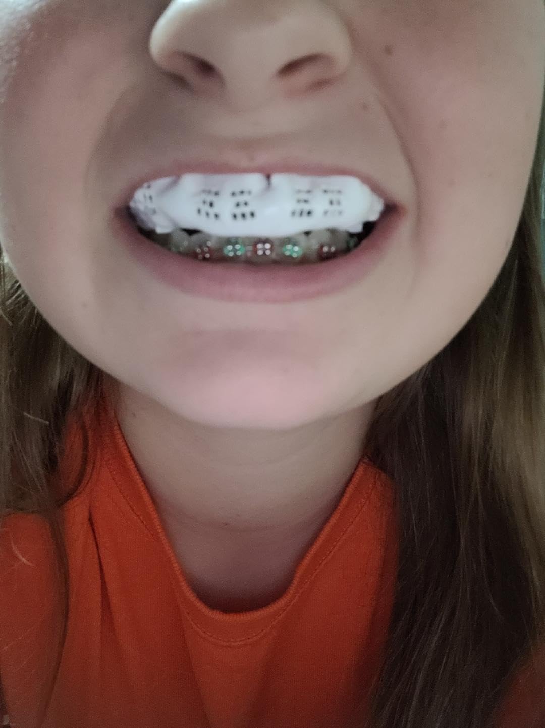 Bulletproof Braces Mouthguard - World's Thinnest & Strongest Sports Mouth Guard for Braces! Basketball Football Lacrosse Wrestling Hockey Rugby BJJ MMA Boxing Mouthpiece - Adult Youth & Kids customer photo 1