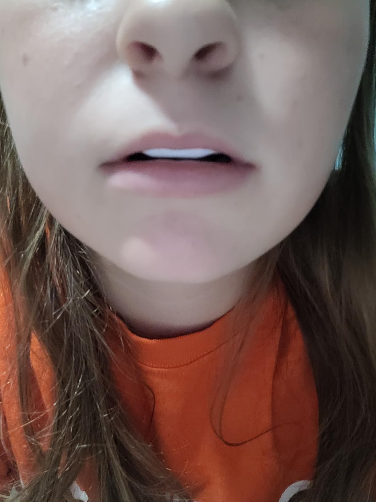 Bulletproof Braces Mouthguard - World's Thinnest & Strongest Sports Mouth Guard for Braces! Basketball Football Lacrosse Wrestling Hockey Rugby BJJ MMA Boxing Mouthpiece - Adult Youth & Kids customer photo 2