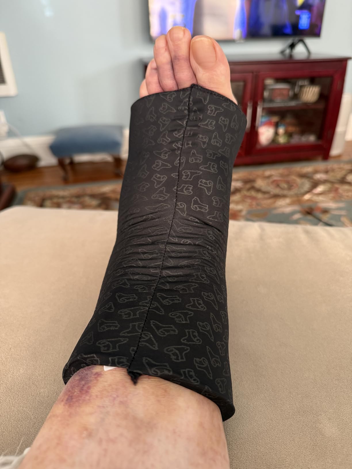 TheraICE Ankle Ice Pack Wrap for Swelling & Sprained Ankle Brace for Women Men, Cold Therapy Foot Heel Spur Support Compression Socks, Plantar Fasciitis & Achilles Tendonitis Sore Feet Pain Relief customer photo 1