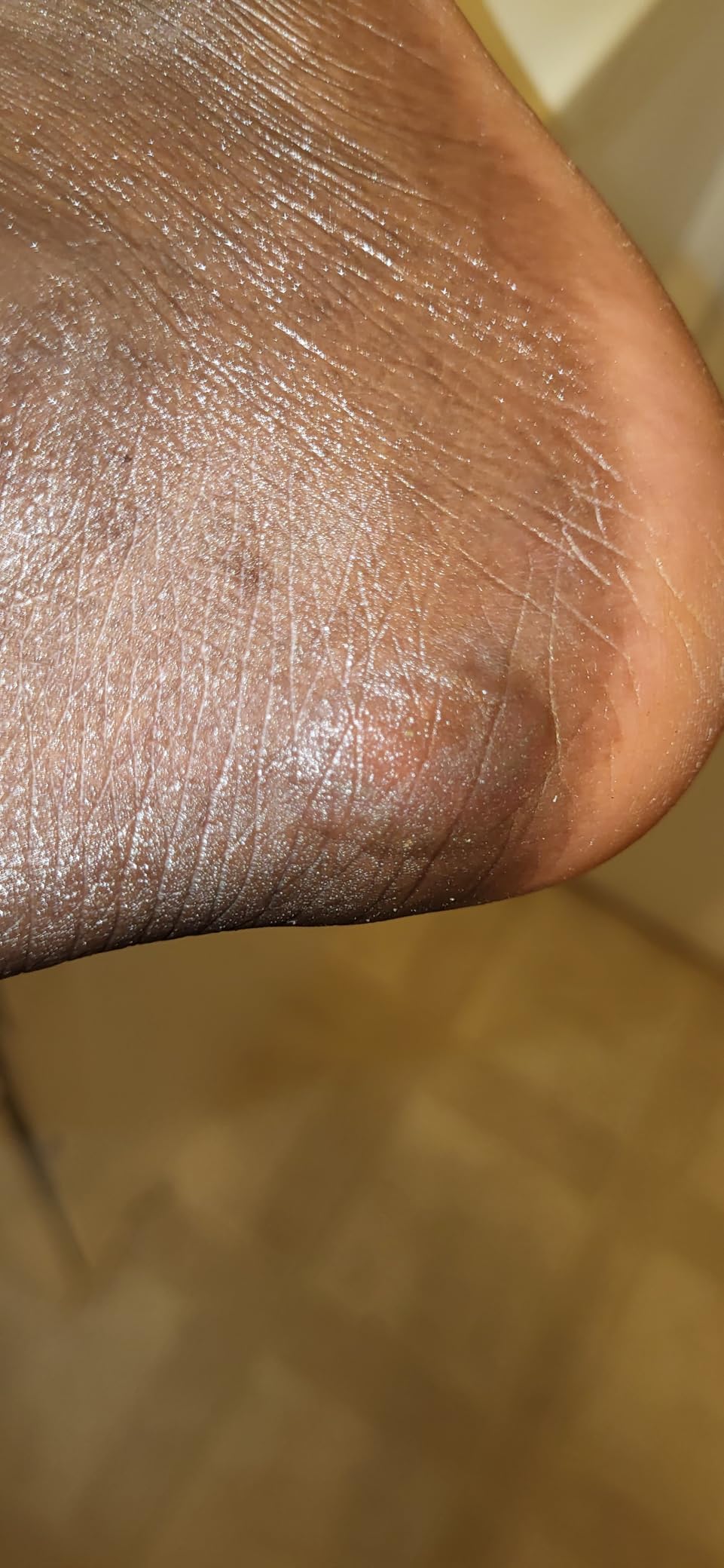 Bont Semi Race III Inline Skates 125mm, 2PF Unity 11.8 Inch Frame, Elemental 125mm Wheels, ABEC 7 Bearings, Fitness and Speed Skating customer photo 2