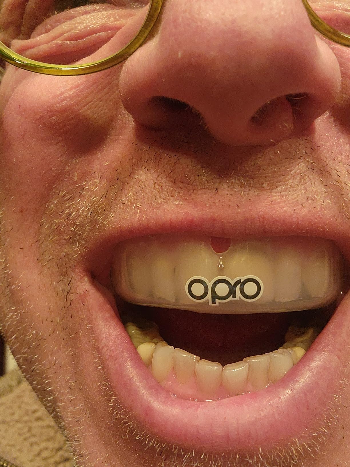 OPRO Instant Custom-Fit Mouth Guard, Dentist-Level Comfort, Protection & Fit - Moldable Mouthguard for Football, Boxing, Rugby, MMA, BJJ, UFC Mouth Piece- Includes Mouth Guard Case (Clear, Adult) customer photo 1