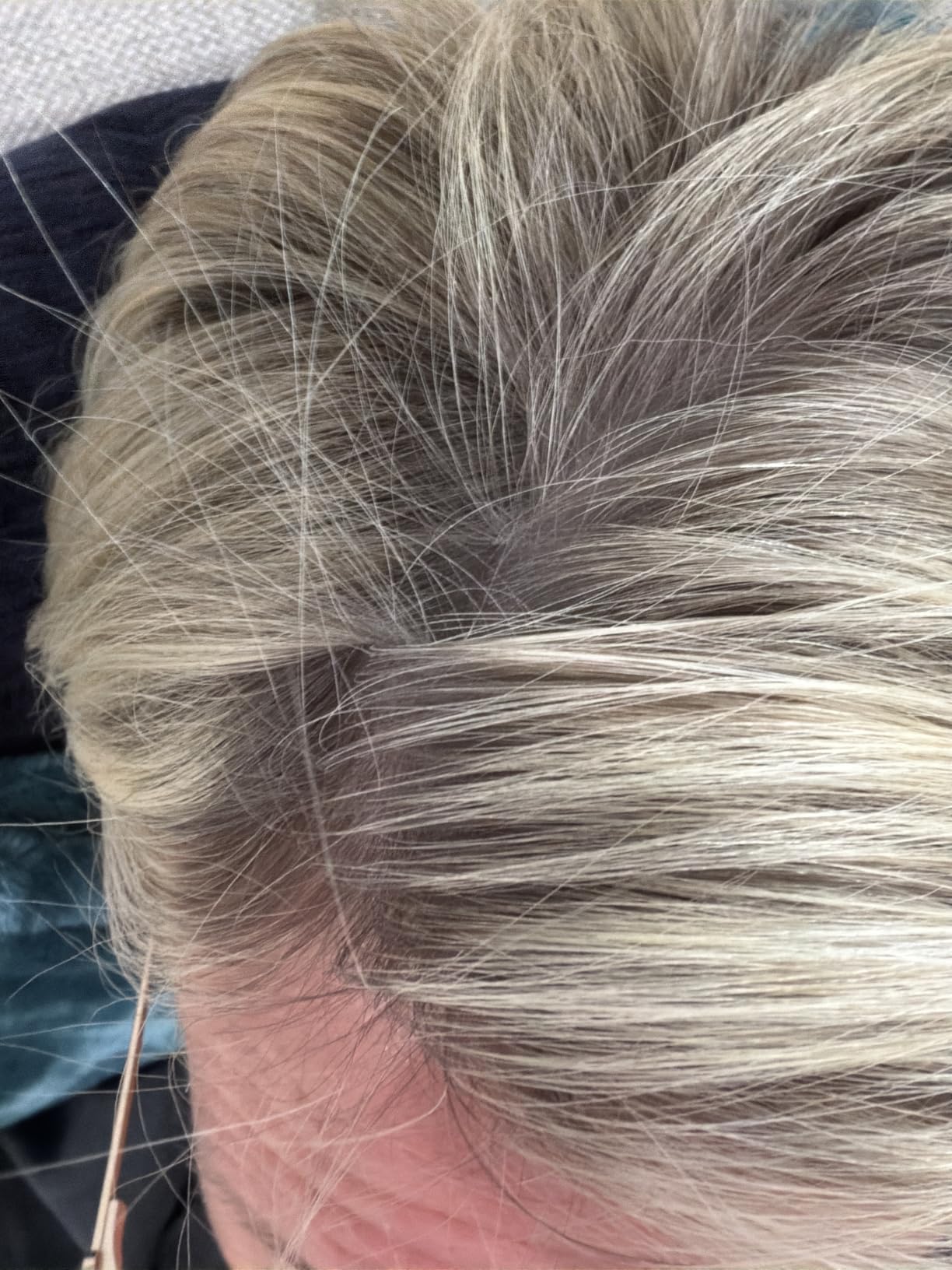 MONDAY HAIRCARE ORIGINAL Dry Shampoo with Keratin, oil-absorbing for All Hair Types 200 mL customer photo 1