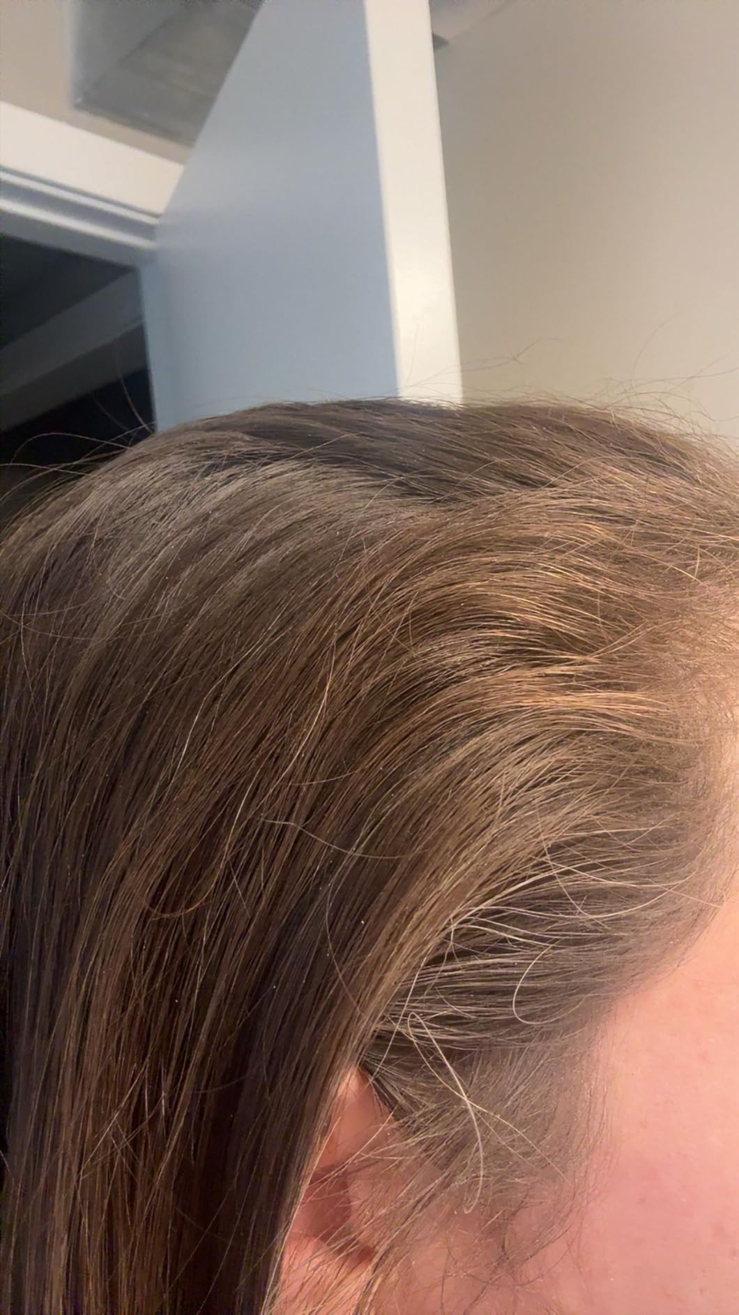 I DEW CARE Tap Secret Dry Shampoo Powder with Biotin & Korean Ginseng - Natural Non-Aerosol Dry Shampoo for Women | Warm Vanilla & Coconut Scent, Volumizing Hair, Travel Size, Stocking Stuffers 0.24Oz customer photo 2