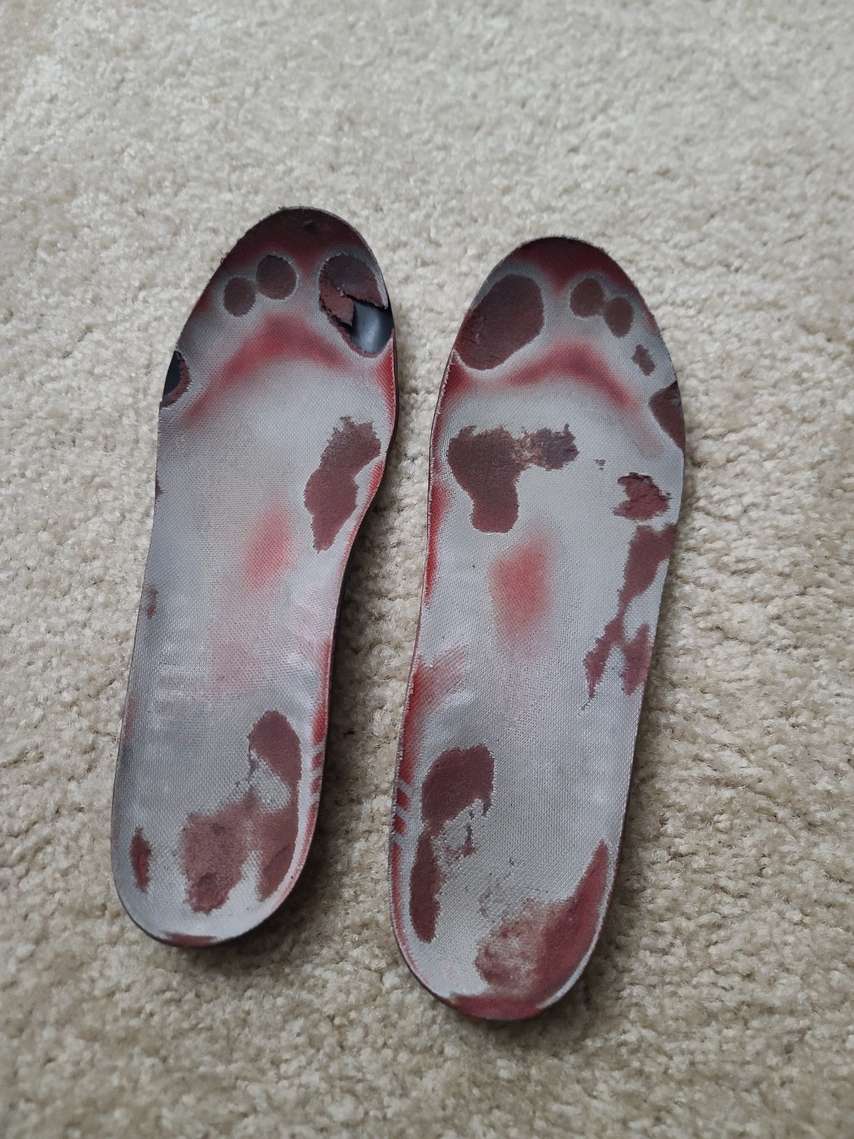 SOLE Active Medium Insoles - Custom Moldable Orthotic Support for Any Arch Type, Plantar Fasciitis Relief - Multiple Sizes customer photo 2