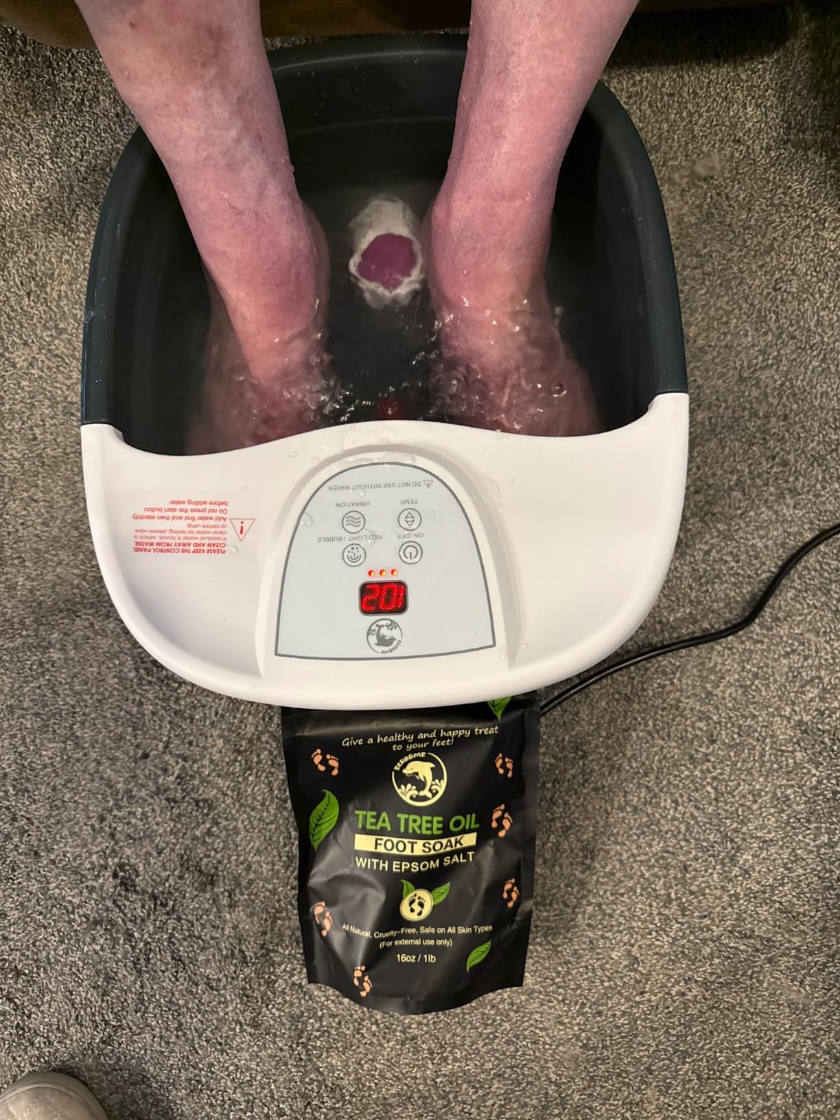 Foot Spa Bath Massager with Heat [2025 Upgraded], Vibration, Temperature Control, Jets, Bubbles and Epsom Salt, Foot Bath Soak Tub with 22 Massage Rollers, Feet Soaking Tub for Relaxation, Purple customer photo 1