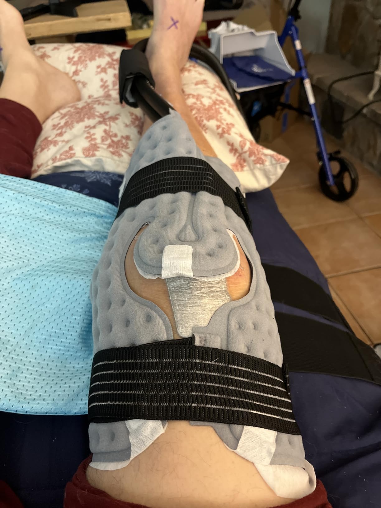 CUEME 20 QT Ice Machine for Knee After Surgery, Programmable Timer Cold Therapy Machine, Knee Replacement Recovery System, Cryotherapy Pain Relief Pad for Shoulder, Hip, Ankle & Foot customer photo 1