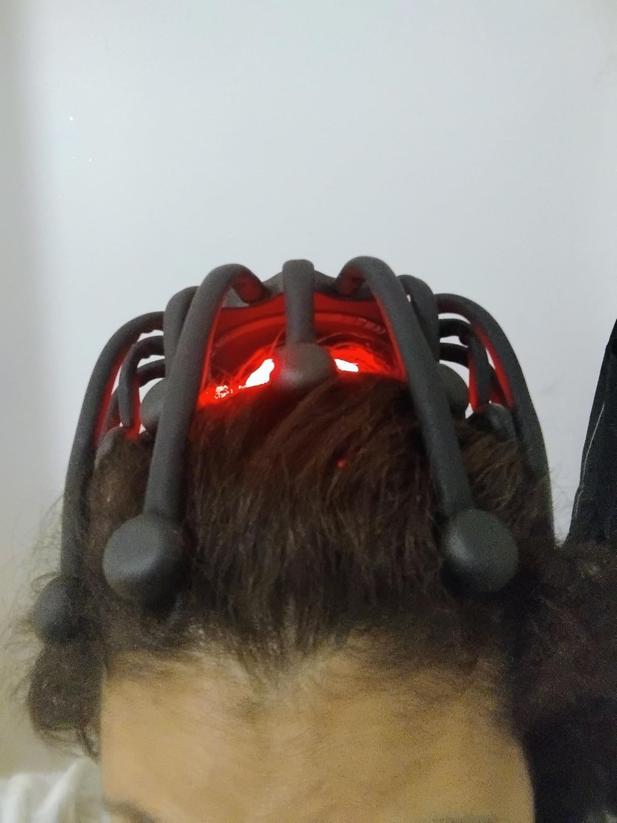 Electric Scalp Massager - Octopus Head Massager Stress Relax, 20 Claw Multi-Configuration Array Vibrating Nodes, 5 Modes, Bluetooth Music, Hair Scalp Relaxation, Fatigue Relief customer photo 1