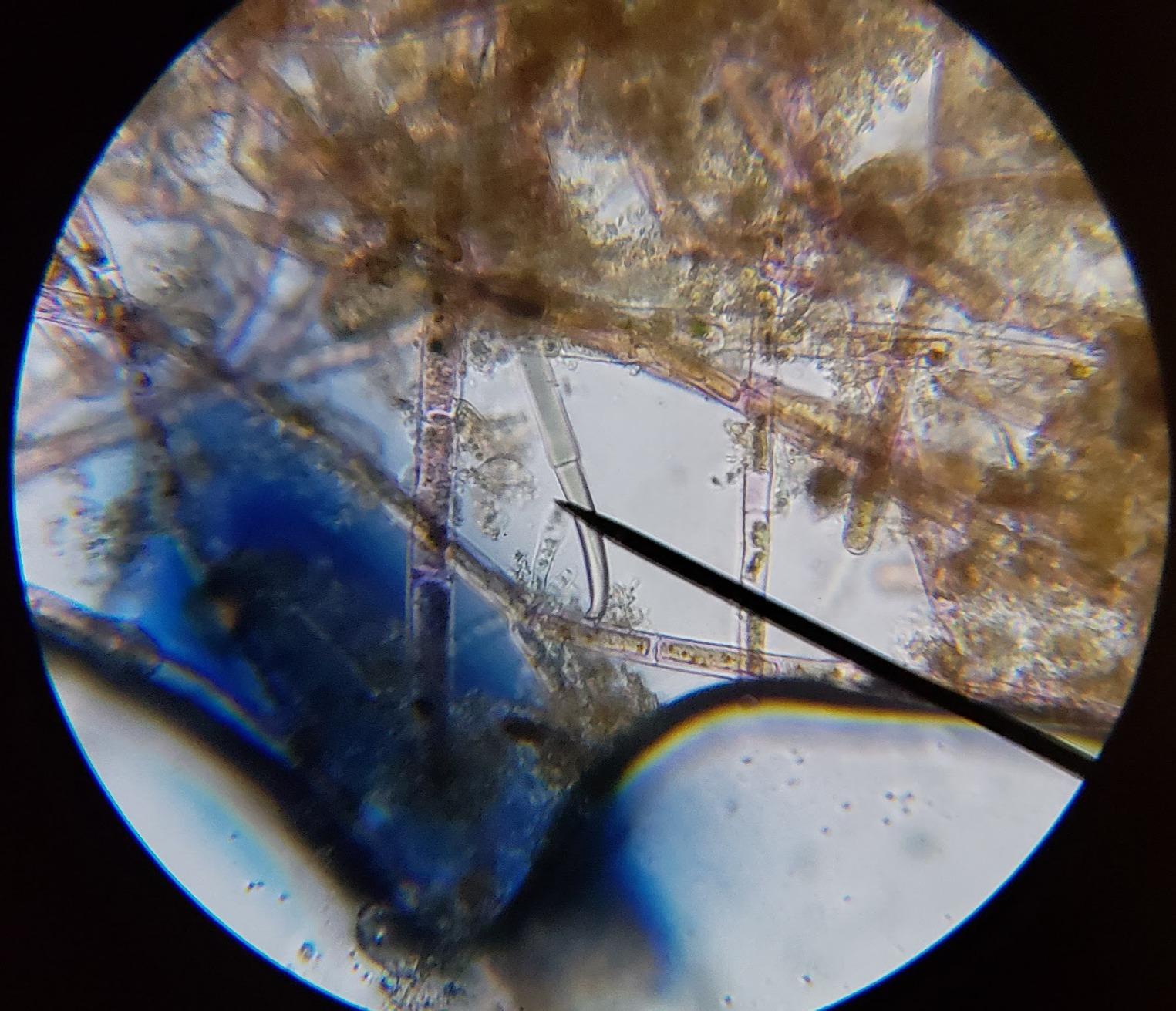 AmScope M150C 1000X All-Metal Optical Glass Lenses Cordless LED, 40X-1000X Magnification Range Compound Biological Microscope, All-Metal Construction, Cordless Battery Powered customer photo 1