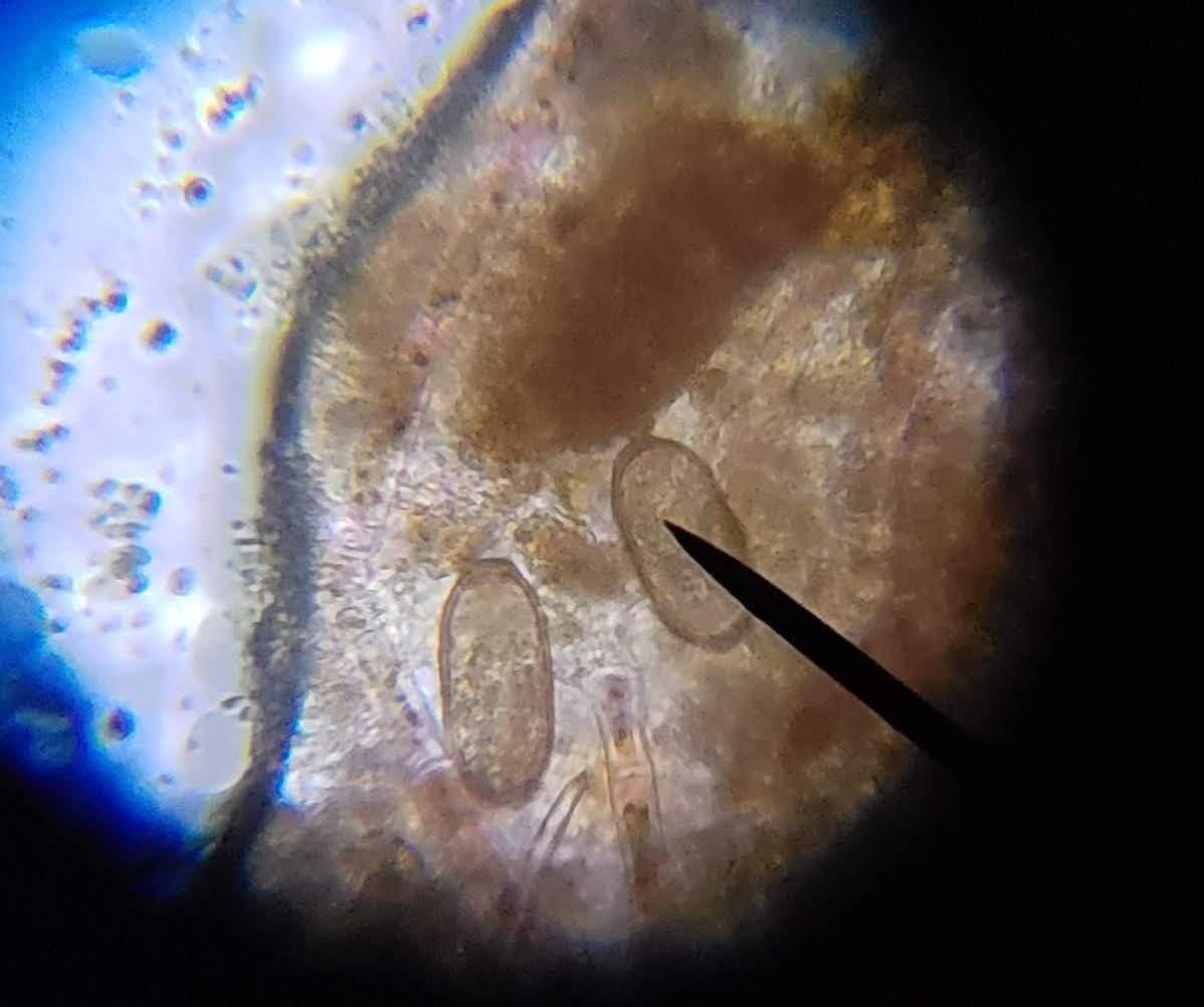 AmScope M150C 1000X All-Metal Optical Glass Lenses Cordless LED, 40X-1000X Magnification Range Compound Biological Microscope, All-Metal Construction, Cordless Battery Powered customer photo 2