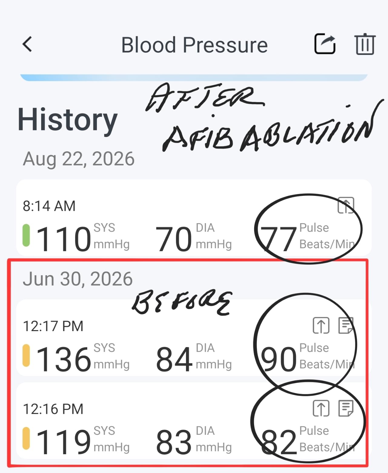 iHealth Track Smart Upper Arm Blood Pressure Monitor with Wide-Range Cuff | Bluetooth BP monitor for standard to large adult arms, compatible with iOS and Android customer photo 1