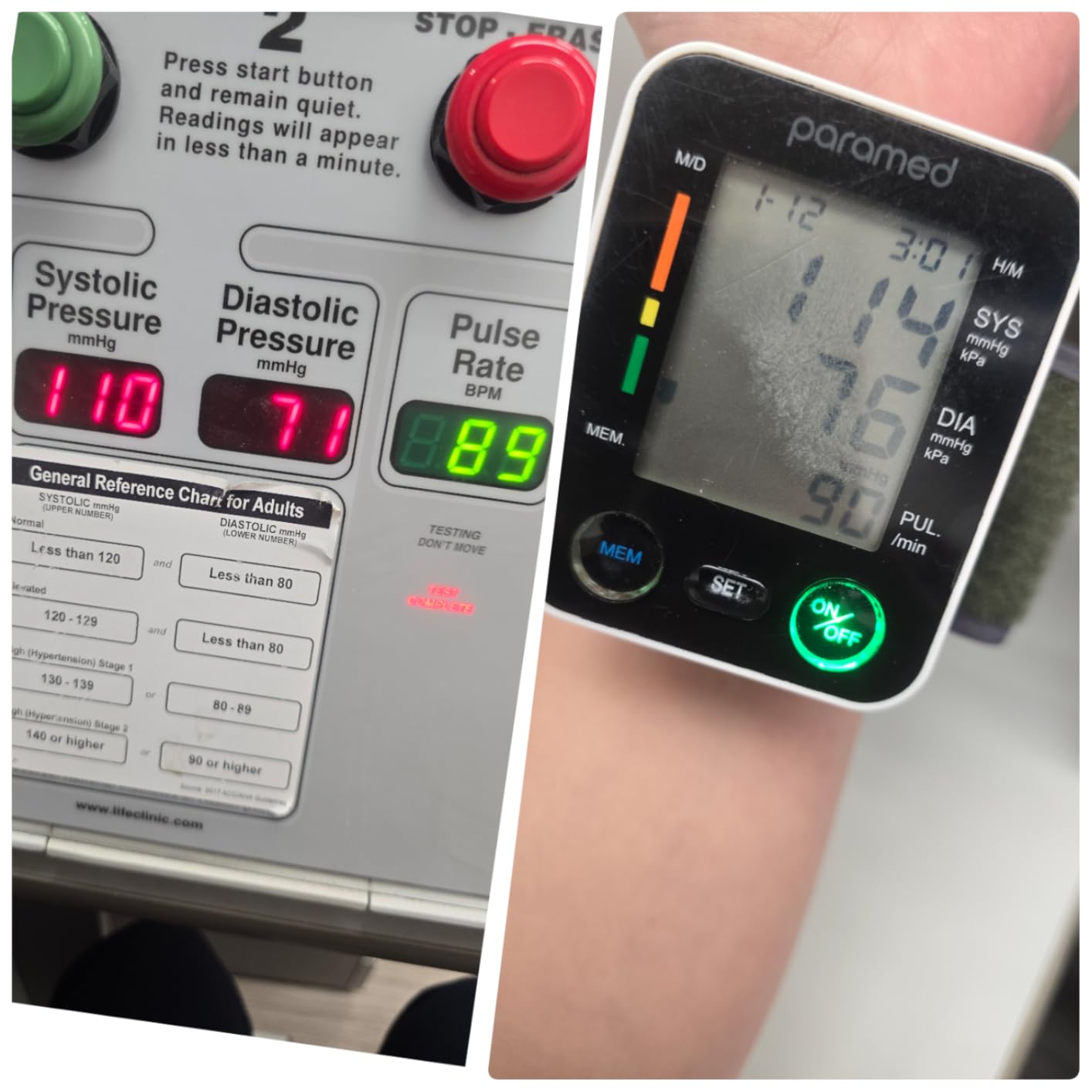 PARAMED Automatic Wrist Blood Pressure Monitor: Blood-Pressure Kit of Bp Cuff + 2AAA and Carrying case - Irregular Heartbeat Detector & 90 Readings Memory Function & Large Display customer photo 1