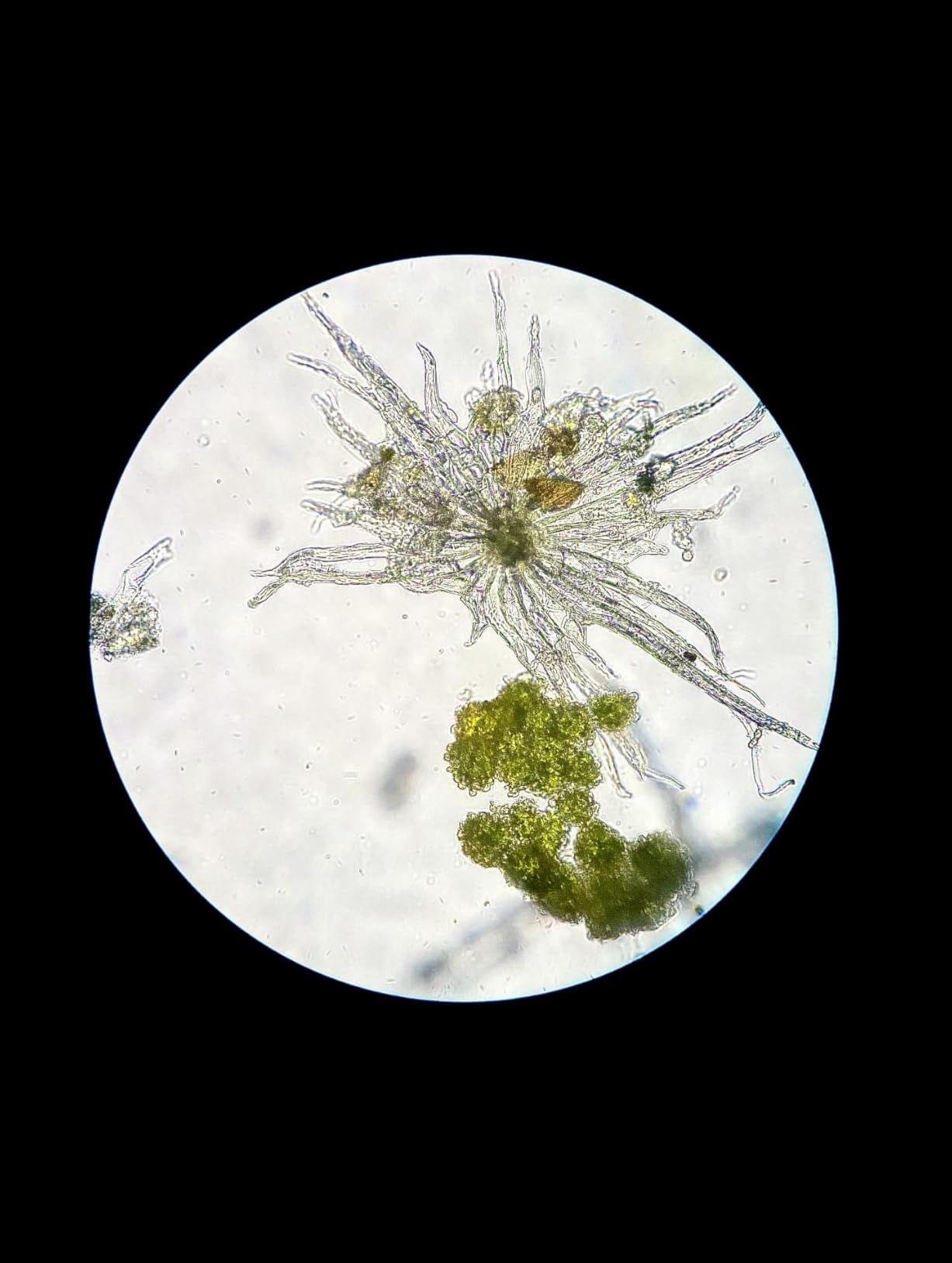 Swift SW380T 40X-2500X Magnification, Siedentopf Head, Research-Grade Trinocular Microscope Compound Lab with Wide-Field 10X/25X Eyepieces, Mechanical Stage, Ultra-Precise Focusing, Camera-Compatible customer photo 2