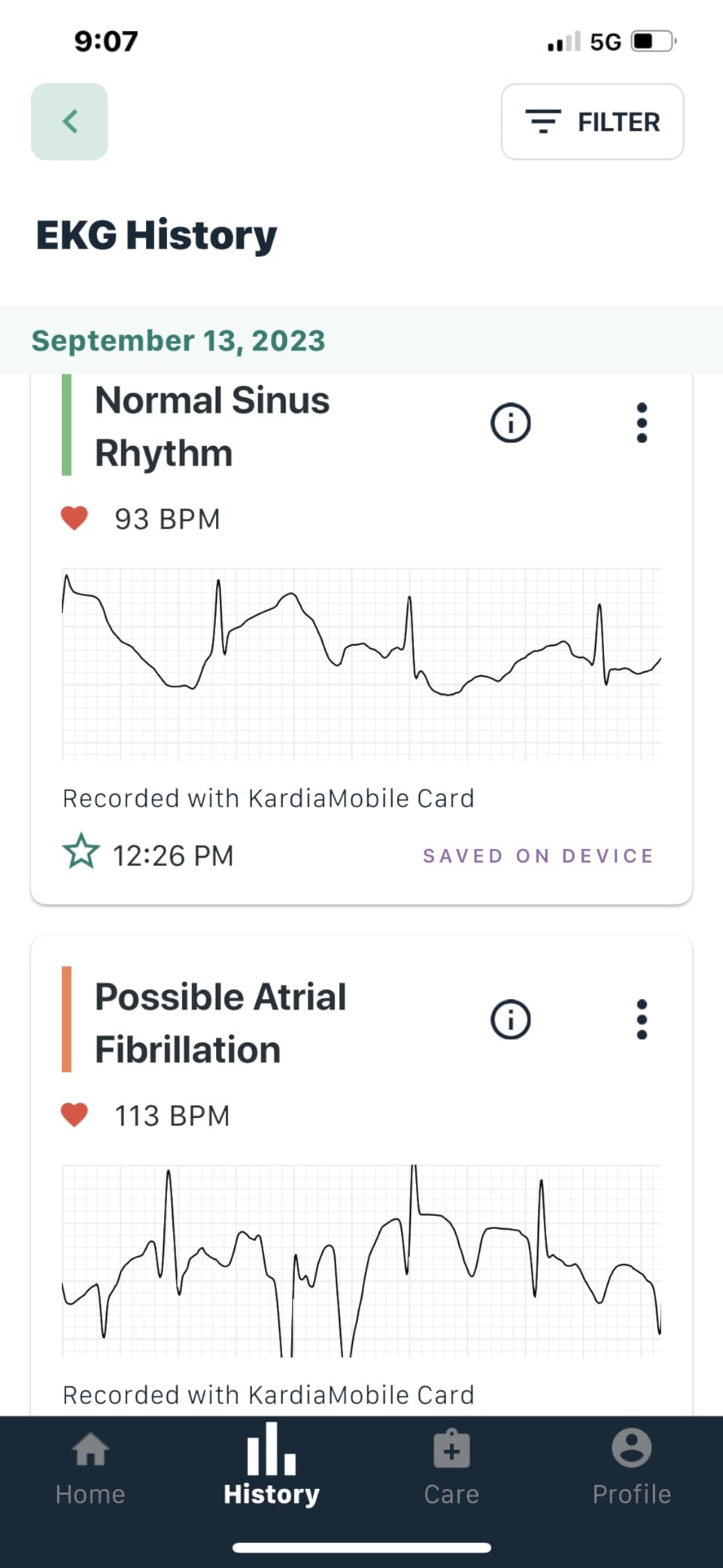 KardiaMobile Card Credit-Card Sized EKG, Medical-Grade & FDA-Cleared Personal Heart Monitor, Bluetooth Enabled, On-The-Go Check-Up Anywhere, Compatible with Most Smartphones, No Subscription Required customer photo 2