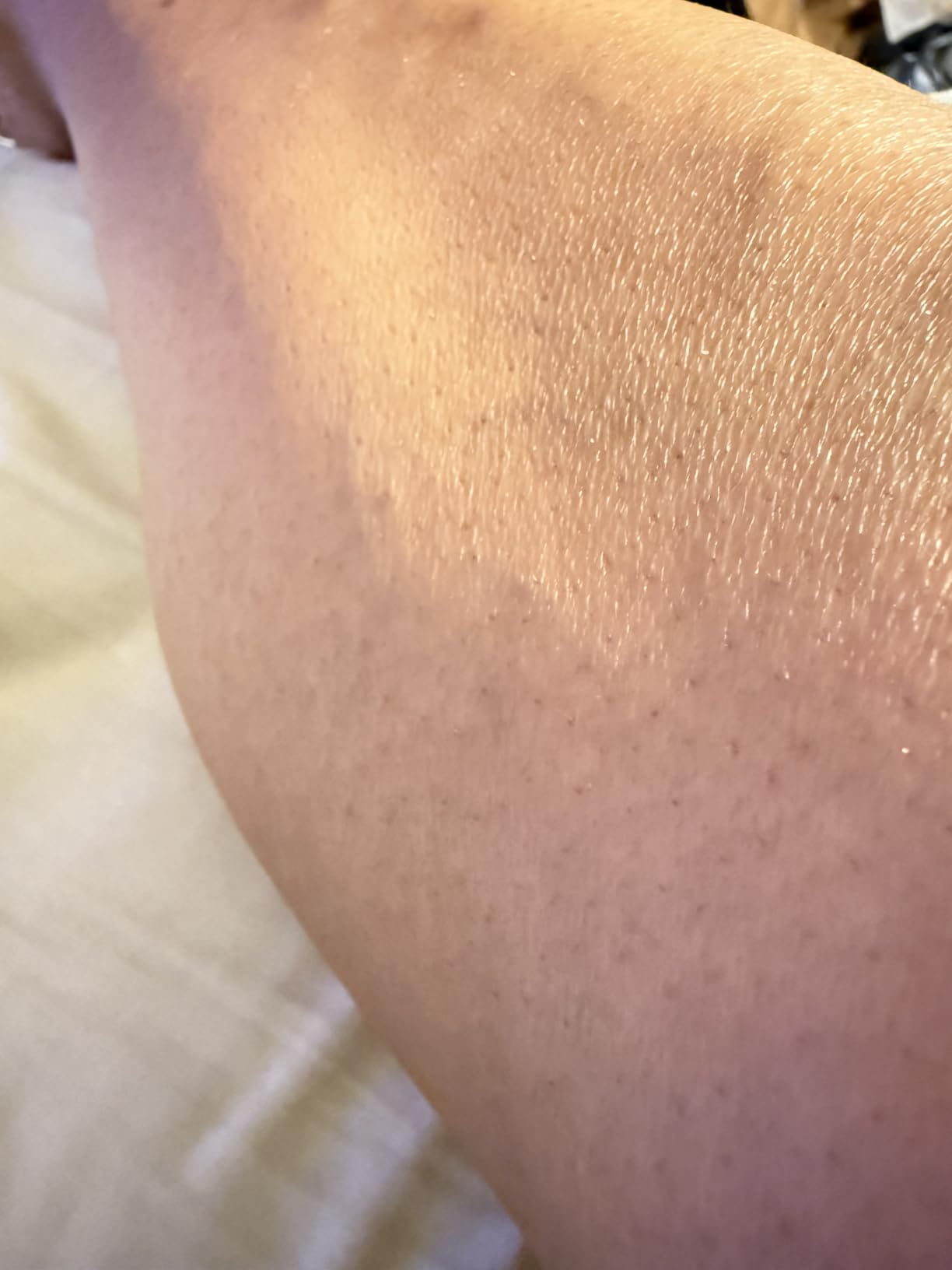 Braun Silk-épil 9 Epilator, Pivoting Head, Wet and Dry, Includes Body Trimmer, Shaver Head and Trimmer Comb, SES9-441 customer photo 1