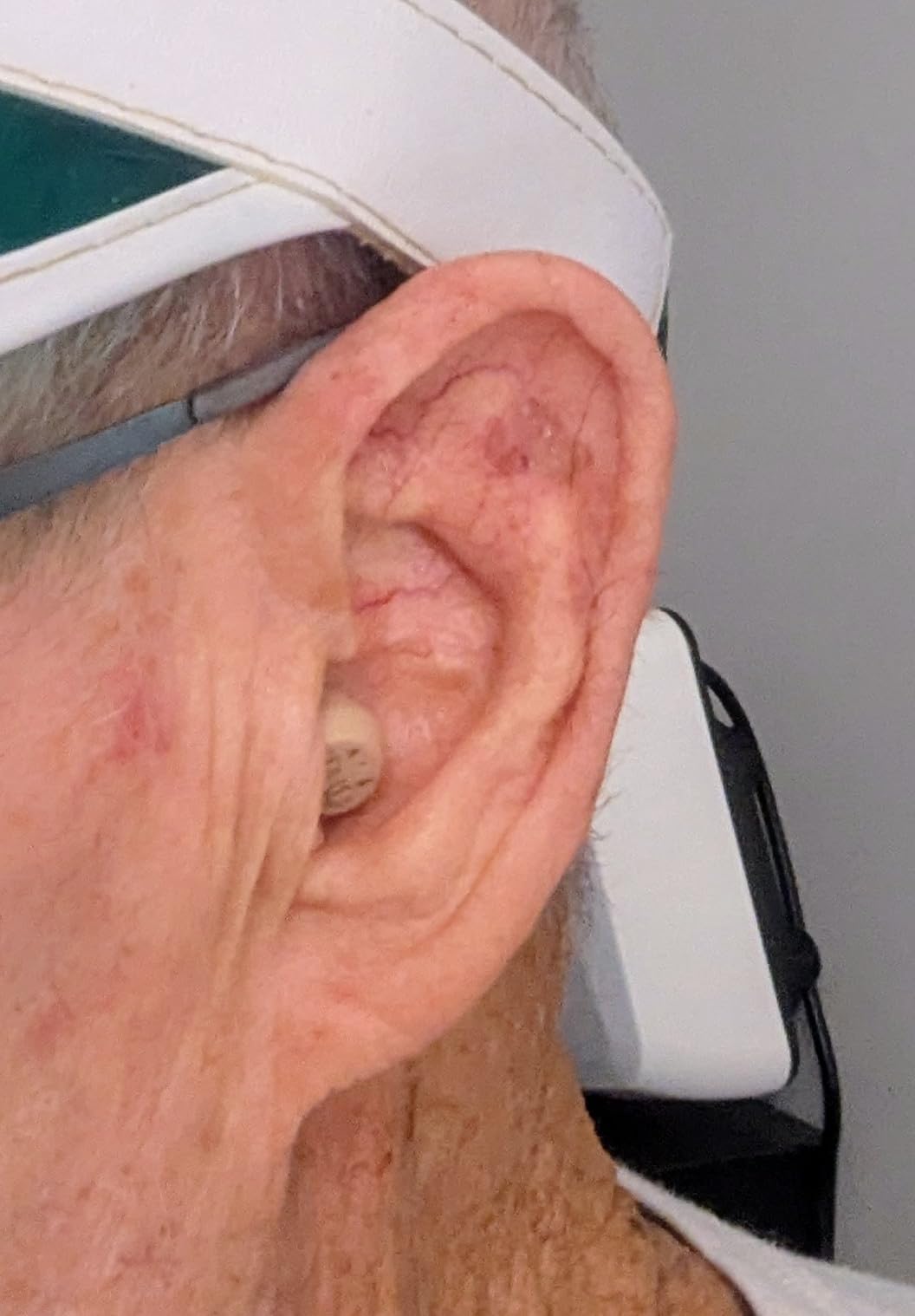 Audien Atom One OTC Hearing Aids | Wireless, Rechargeable, Comfortable, Clear Sound, Small Discreet Design customer photo 1