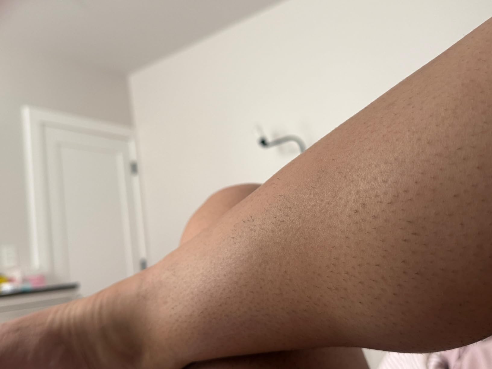 Philips Lumea IPL - Salon-Like Laser Hair Removal for Women, Permanent Hair Reduction Device At Home for Face & Body - Safe & Painless for Face, Bikini, Body, 5 Settings & Skin Sensors, BRI984/03 customer photo 1
