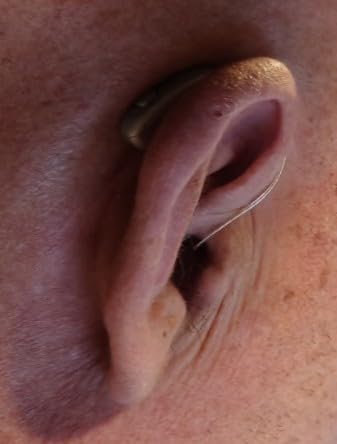 Jabra Enhance Select 700 Clinic-Strength Hearing Aids + Audiology Support | Licensed Audiology Services Included, Bluetooth LE Audio & Streaming for iOS/Android, Nearly Invisible & Comfortable customer photo 1