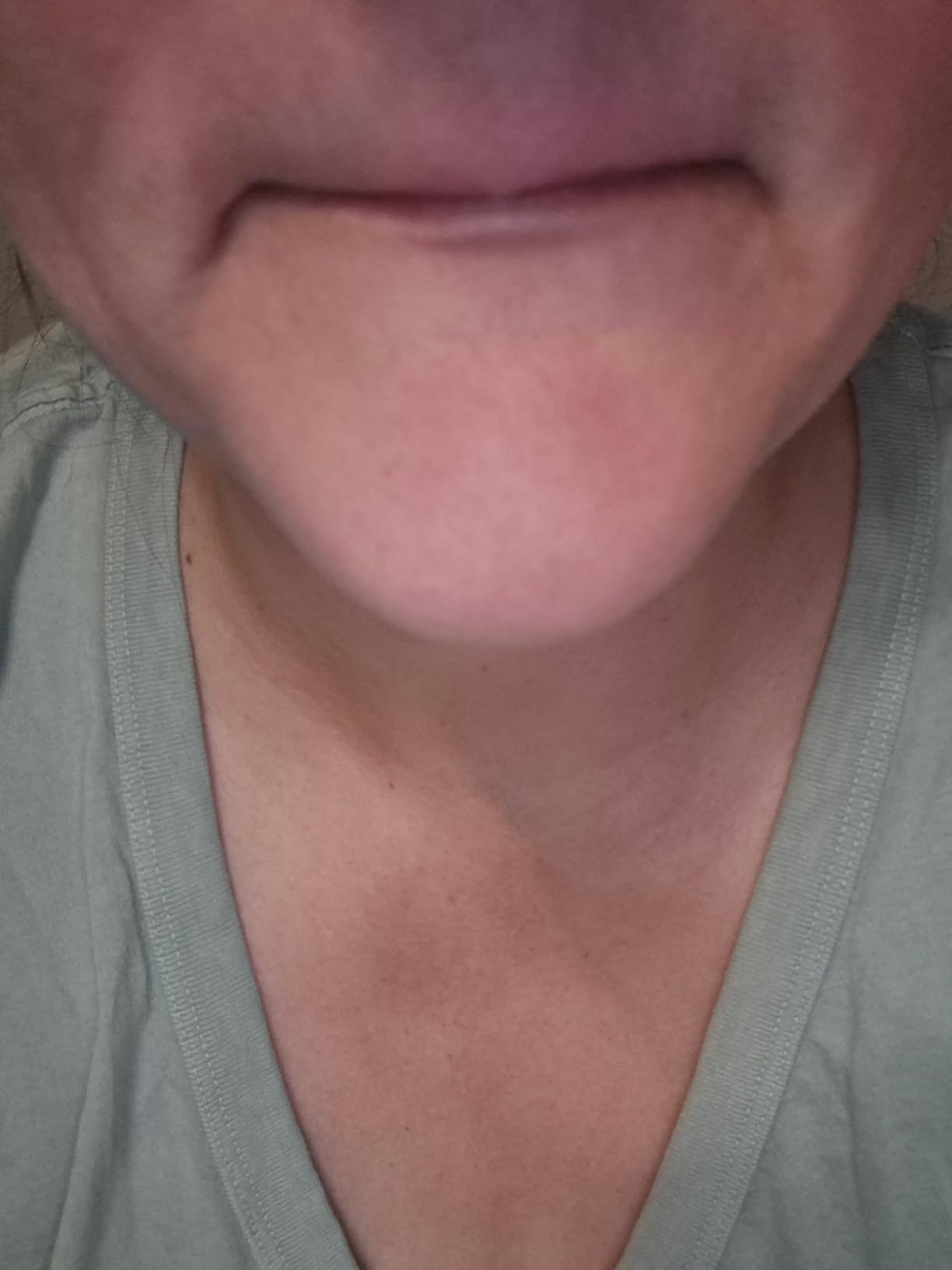 Braun IPL, Silk·Expert Pro 5, IPL Hair Removal for Women and Men, Permanent Laser Hair Reduction At-Home, 1 Head, IPL5100 customer photo 2