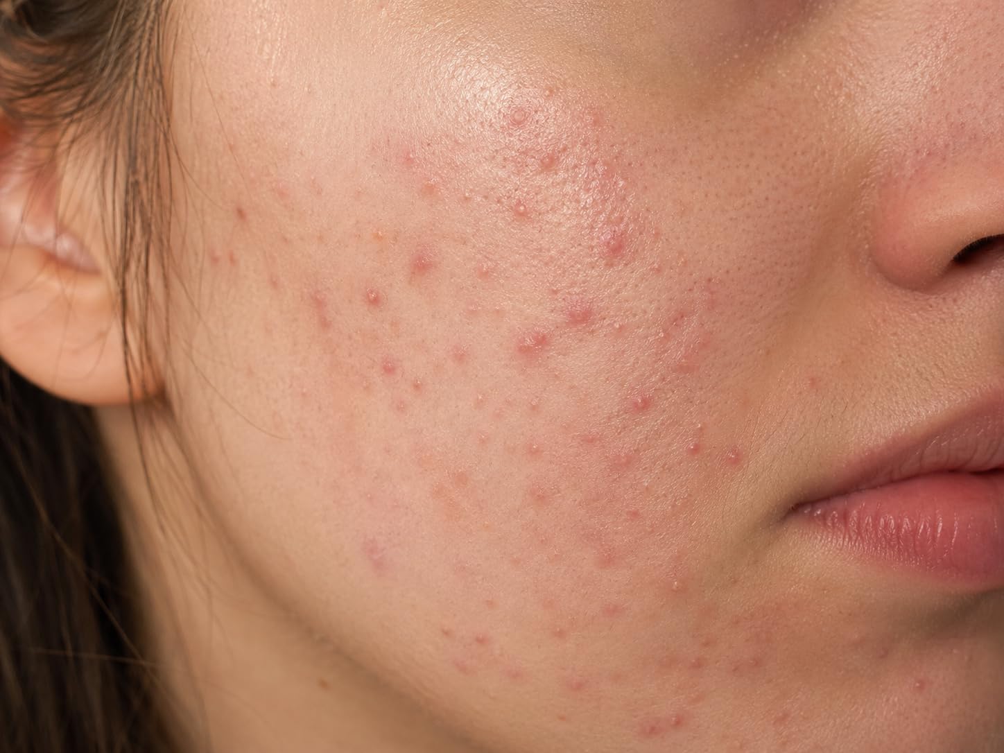 The Ordinary Glycolic Toner customer photo 2